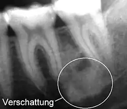 Verschattung