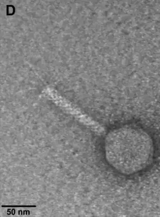 EM-Nahaufnahme eines Partikels von Escherichia-Phage vB_EcoM-VpaE1 (Felixounavirus VpaE1) mit Schwanzfibern.[10]