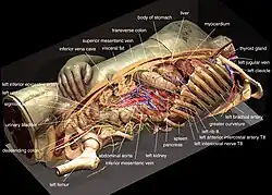 Rekonstruktion der inneren Organe des Visible Human
