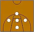 1-3-1-Zone