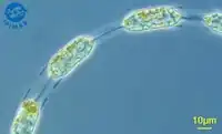 H. sinensis, Kette in Gürtelansicht (Phasenkontrastaufnahme), Probe aus dem Atlantik vom November 2007.